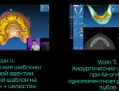 Курсы в городе Москва, Онлайн-курс по хирургическим шаблонам в системе RealGuide